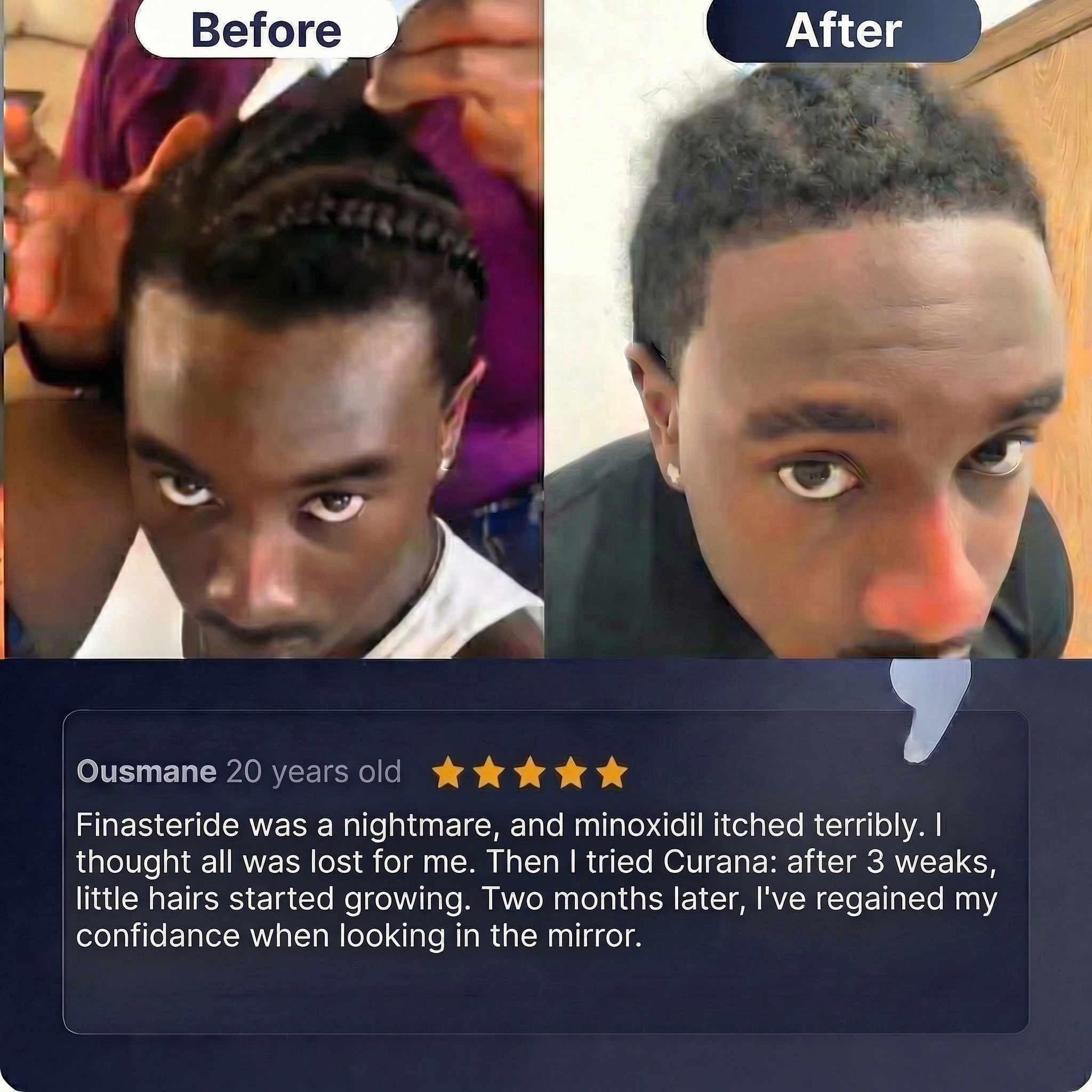 Curana - Hair regrowth serum